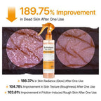 Body Keratin Care  Acid Turmeric Spray with Gentle Body Brightening & Exfoliating Peeling Solution Korean Skincare, 6.76 fl.oz