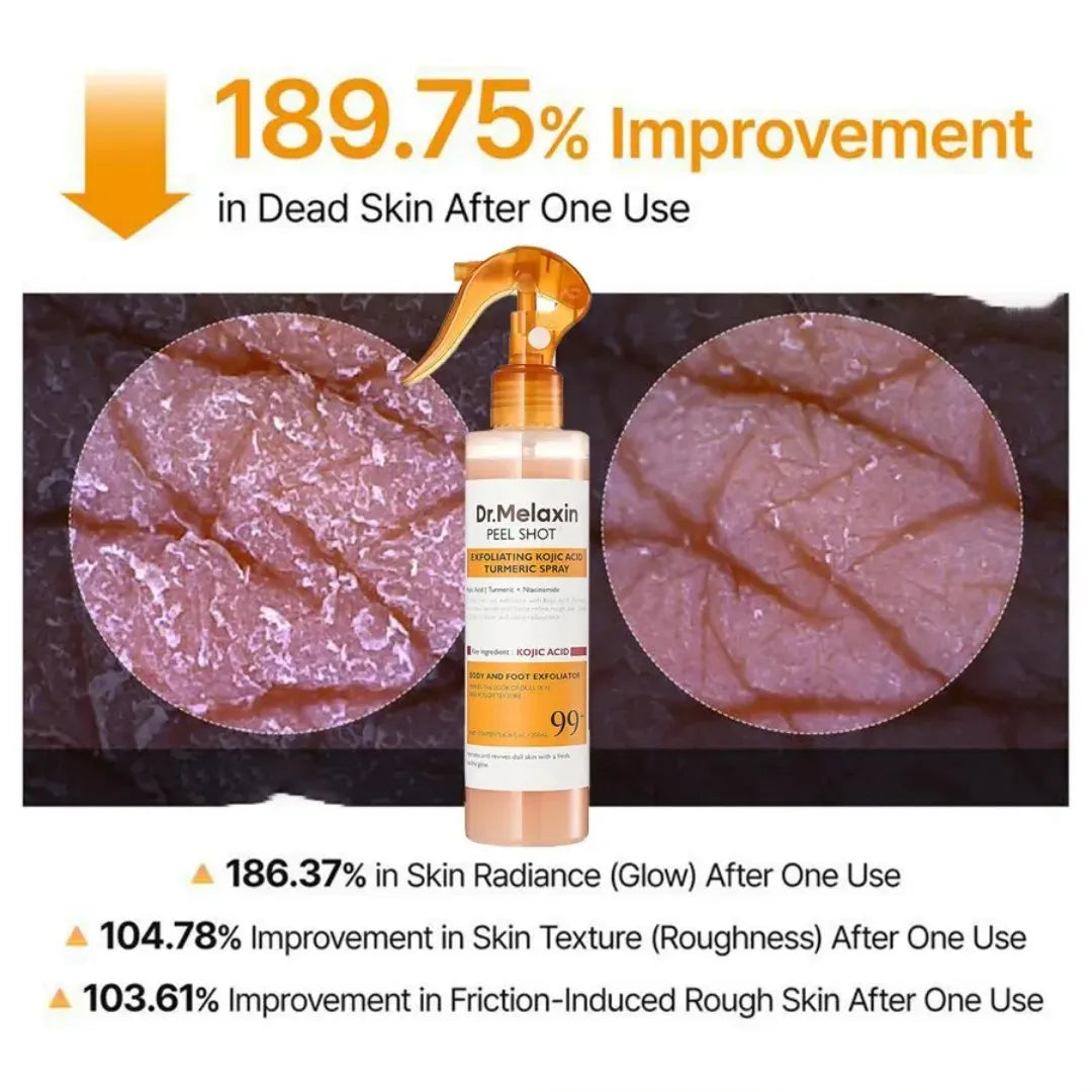 Body Keratin Care  Acid Turmeric Spray with Gentle Body Brightening & Exfoliating Peeling Solution Korean Skincare, 6.76 fl.oz