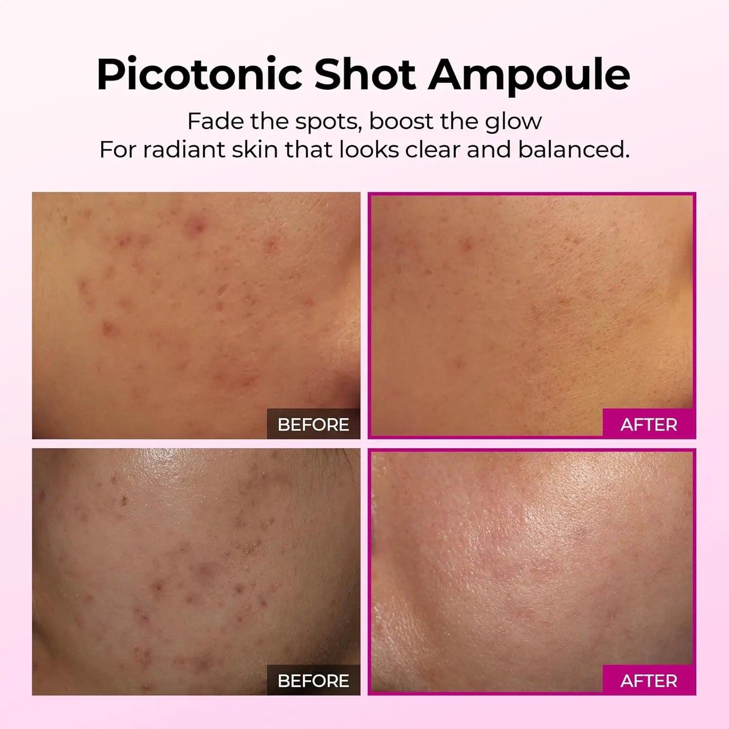 Cemenrete Picotonic Shot Calcium Serum for Firming Density collagen serum Even Skin Tone & Skin Clarity Anti-aging Dark spot