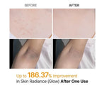 Body Keratin Care  Acid Turmeric Spray with Gentle Body Brightening & Exfoliating Peeling Solution Korean Skincare, 6.76 fl.oz